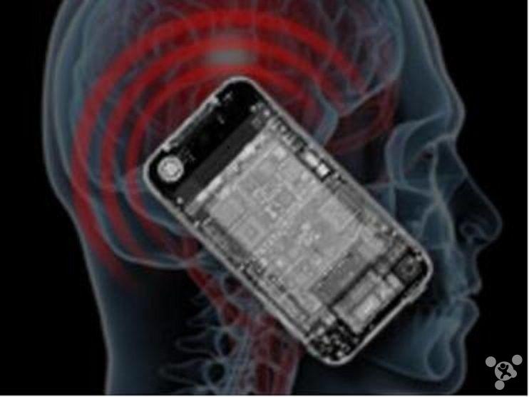 Science fiction sense of full marks! The smart phones of the future will be implanted in the head